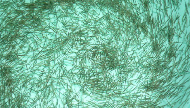 lợi ích nucleotide trong thúc ăn tôm thẻ